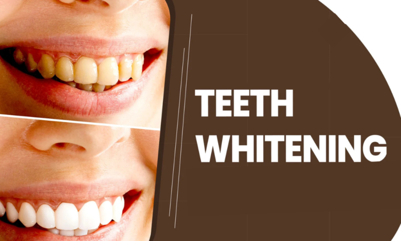 teeth whitening near me